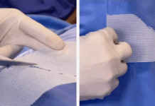 Dr. Marcelo Almeida traz para o norte técnica inédita em cirurgias mamárias