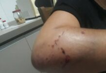 Servidora do SAAE é atacada por cachorro durante leitura de hidrômetro em Vilhena