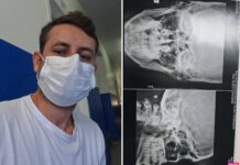 Morador de Vilhena reclama de atendimento no Posto de Saúde da Avenida Brigadeiro