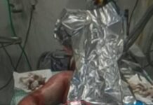 Homem que teria ateado fogo no próprio corpo morre no HR de Vilhena