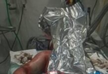 Homem coloca fogo no próprio corpo e esposa fica ferida ao tentar salvá-lo em Vilhena