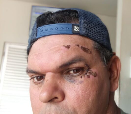 Jailton Delogo denuncia dificuldades de acessibilidade em calçadas para pessoas com deficiência