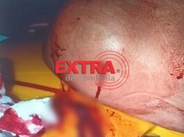 Homem é esfaqueado pelas costas e acaba preso no hospital por estar evadido do sistema prisional em Vilhena