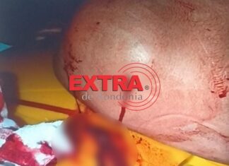 Homem é esfaqueado pelas costas e acaba preso no hospital por estar evadido do sistema prisional em Vilhena